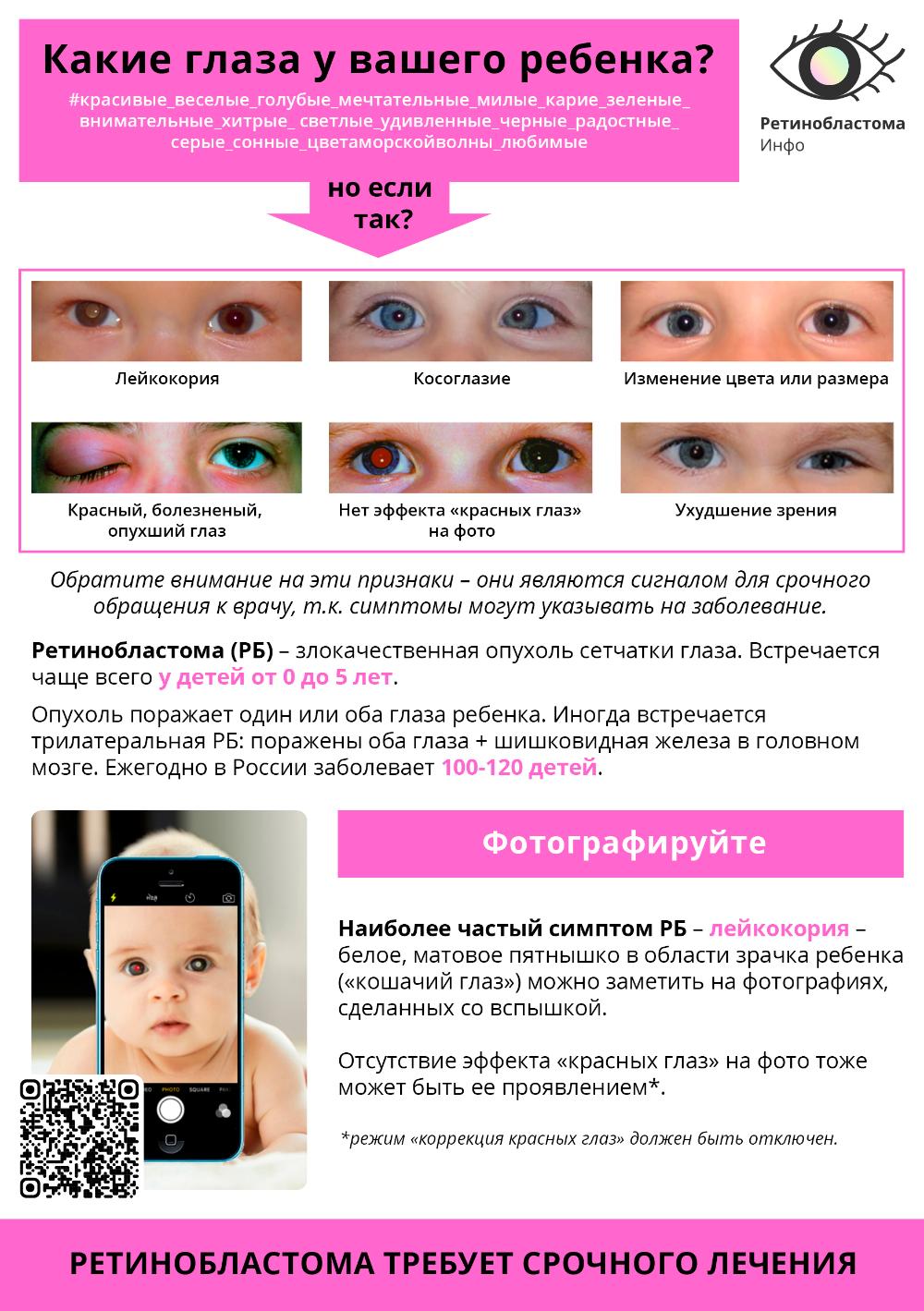 Как заметить ранние симптомы ретинобластомы у детей?  ⁣